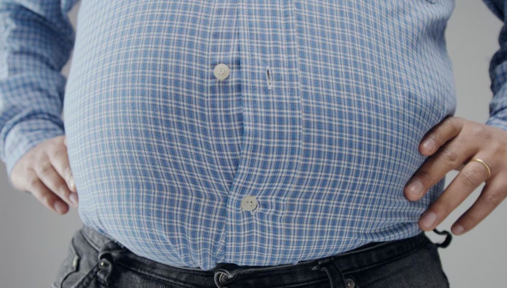 Study: Body's Response Determines Success of Obesity Therapy