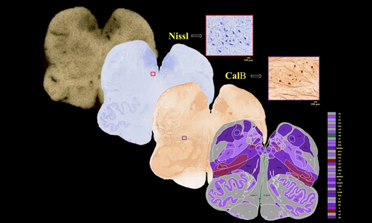 Indian Scientists Create World's Most Detailed 3D Digital Map of the Human Brain