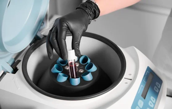 Japanese Firm Invests Rp539 Billion to Build Plasma Industry