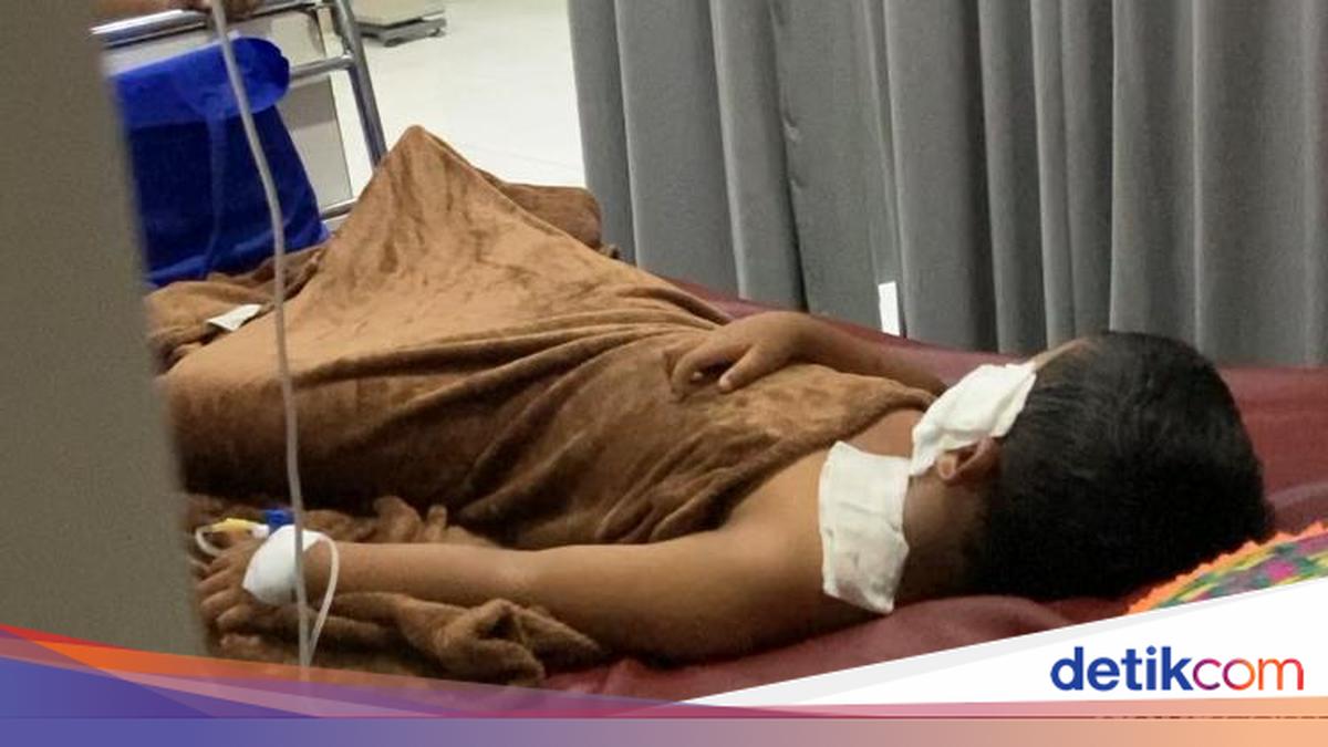 Gas Balloon Explodes During Cooperative Day Event in Klungkung, 11 Injured