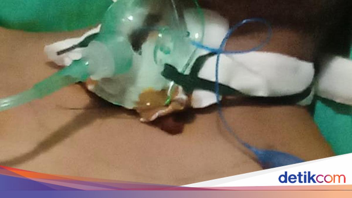 Jembrana Resident's Throat Slashed by Dangling WiFi Cable, Vocal Cords Torn