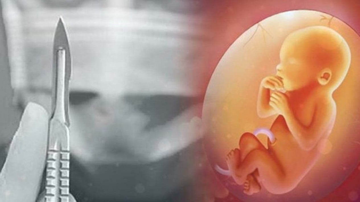 Viral, East Java Raka Runner-Up Allegedly Forced Woman to Have Abortion