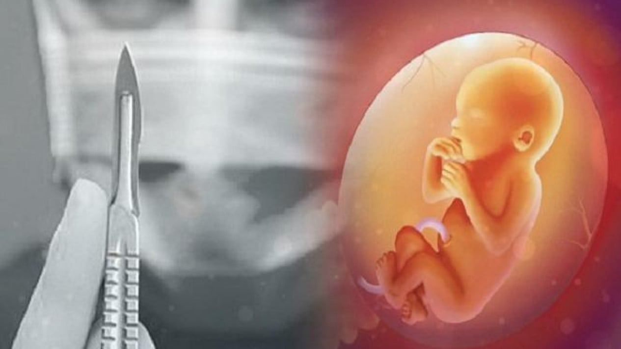 East Java Raka Runner-Up Allegedly Asked Woman to Have Abortion, Organisation Forms Special Team