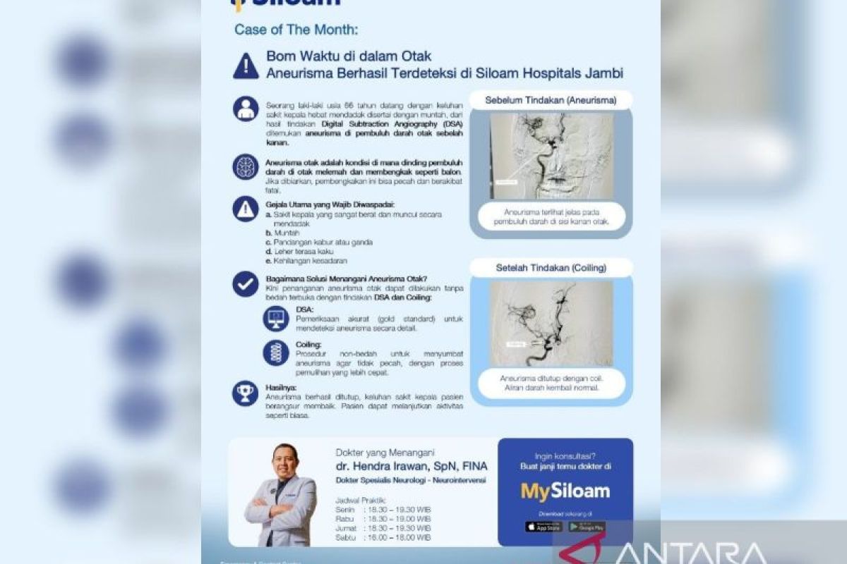 Siloam Jambi successfully treats brain aneurysm without open surgery
