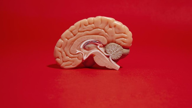 Understanding Brain DSA, an Examination for Cerebral Blood Vessel Abnormalities