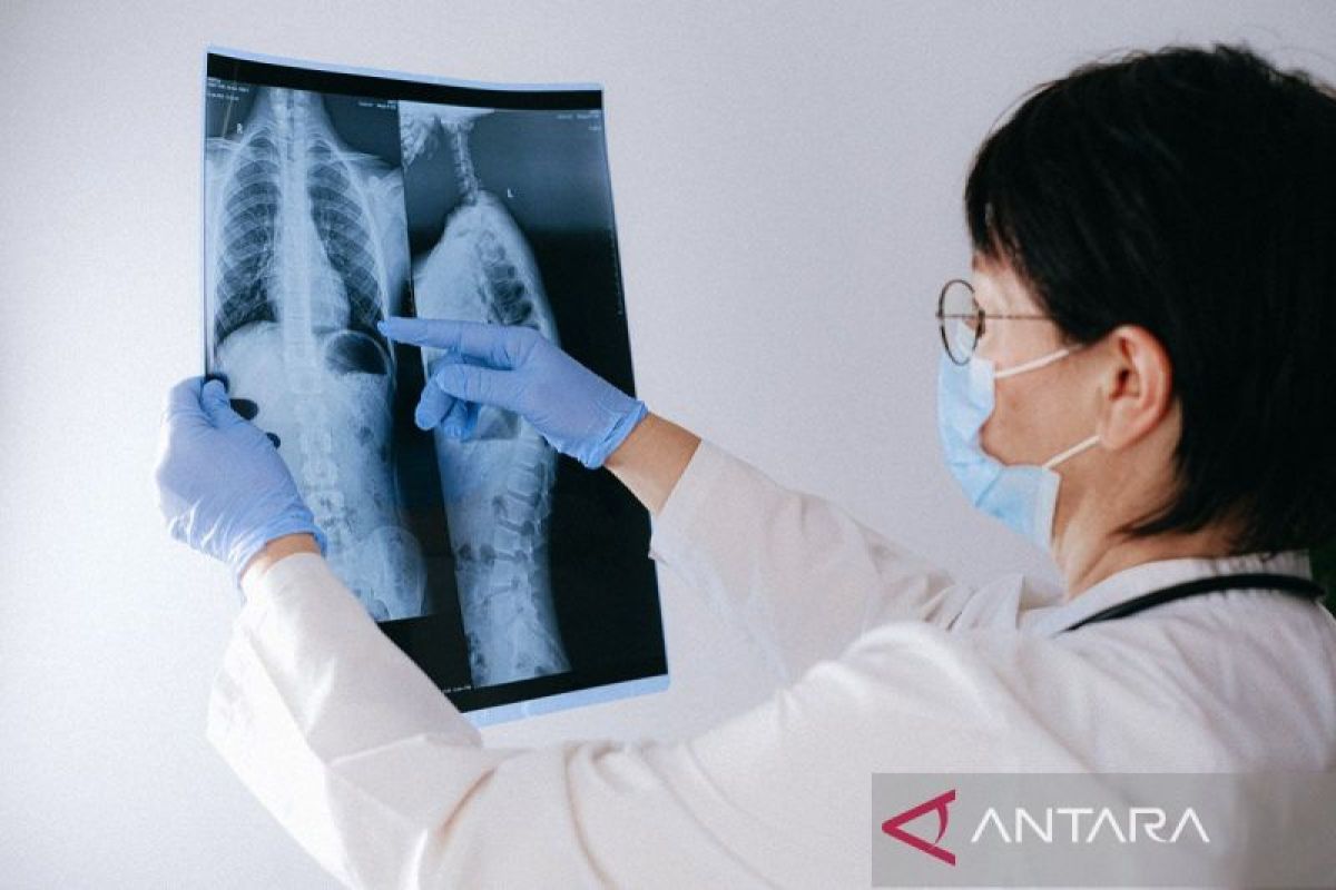 Strengthening patient navigation crucial to accelerate lung cancer services
