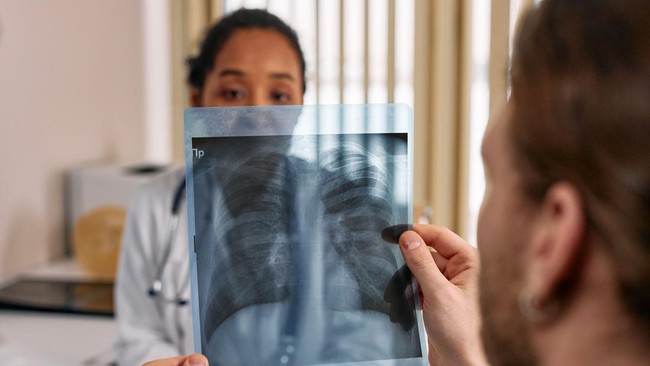 Indonesia Develops New Lung Cancer Therapy