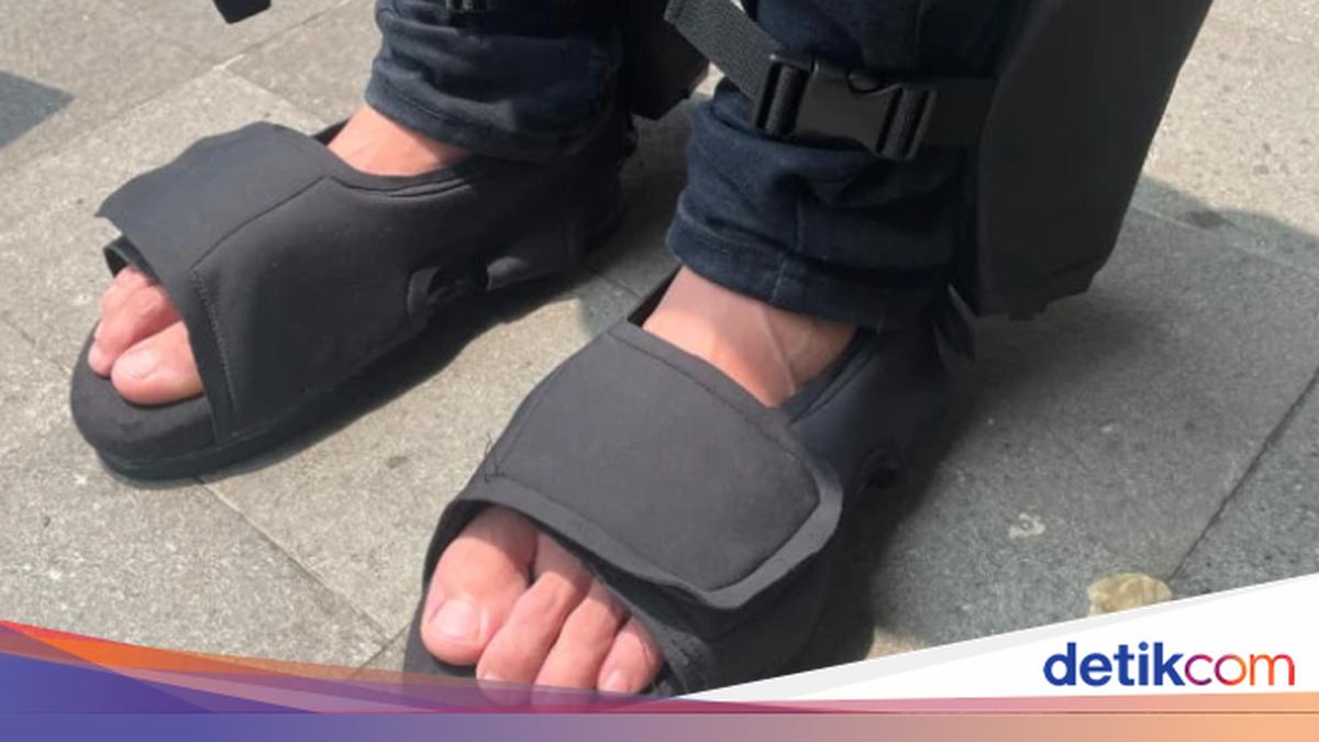 UGM Student-Made Sandals Can Detect Diabetes Complications