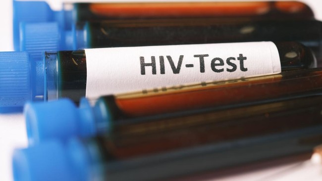 HIV Cases Surge, This Nation Declares National Crisis Status
